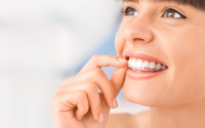 Dudas de la ortodoncia invisible