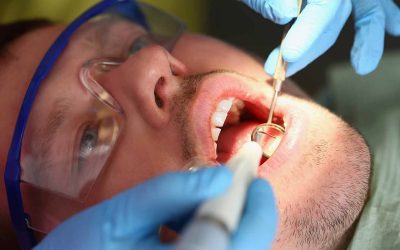 ¿Qué tipos de tratamientos existen para la periodontitis?