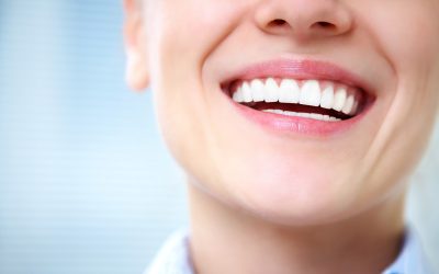 ¿Cuáles son los tratamientos dentales estéticos más populares?