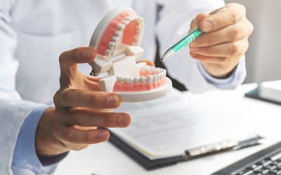 ¿Es compatible la ortodoncia con los implantes dentales?