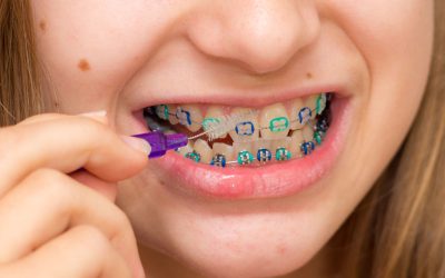 Cómo saber si tu hijo necesita ortodoncia