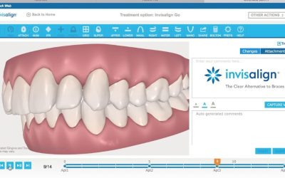 Qué es el clincheck de invisalign