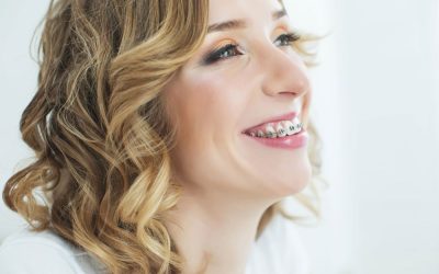 ¿Qué ortodoncia es la mejor para mí?