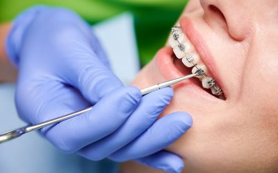 ¿Qué tipos de ortodoncia existen?